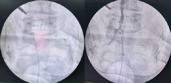 ScreenShot_2026-04-03_170150_519